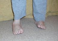 Feet September 2004 after last operations